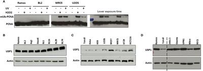 Expression of Constitutive Fusion of Ubiquitin to PCNA Restores the Level of Immunoglobulin A/T Mutations During Somatic Hypermutation in the Ramos Cell Line